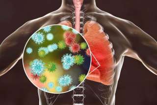 Respiratory Virus Oligo Panel